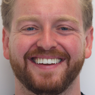 872.22164-BeforeAndAfter_02_02